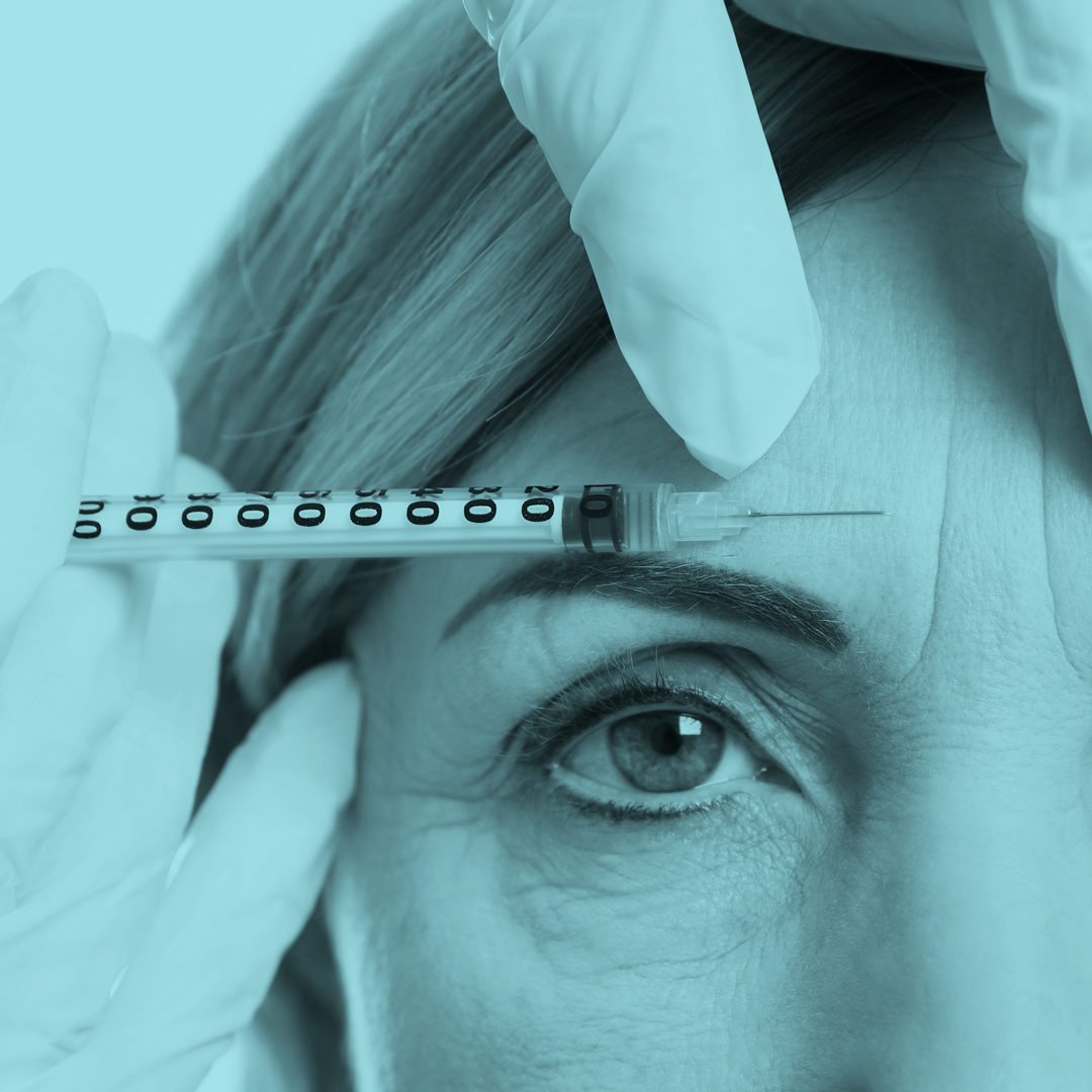 Mimické vrásky a botulotoxin