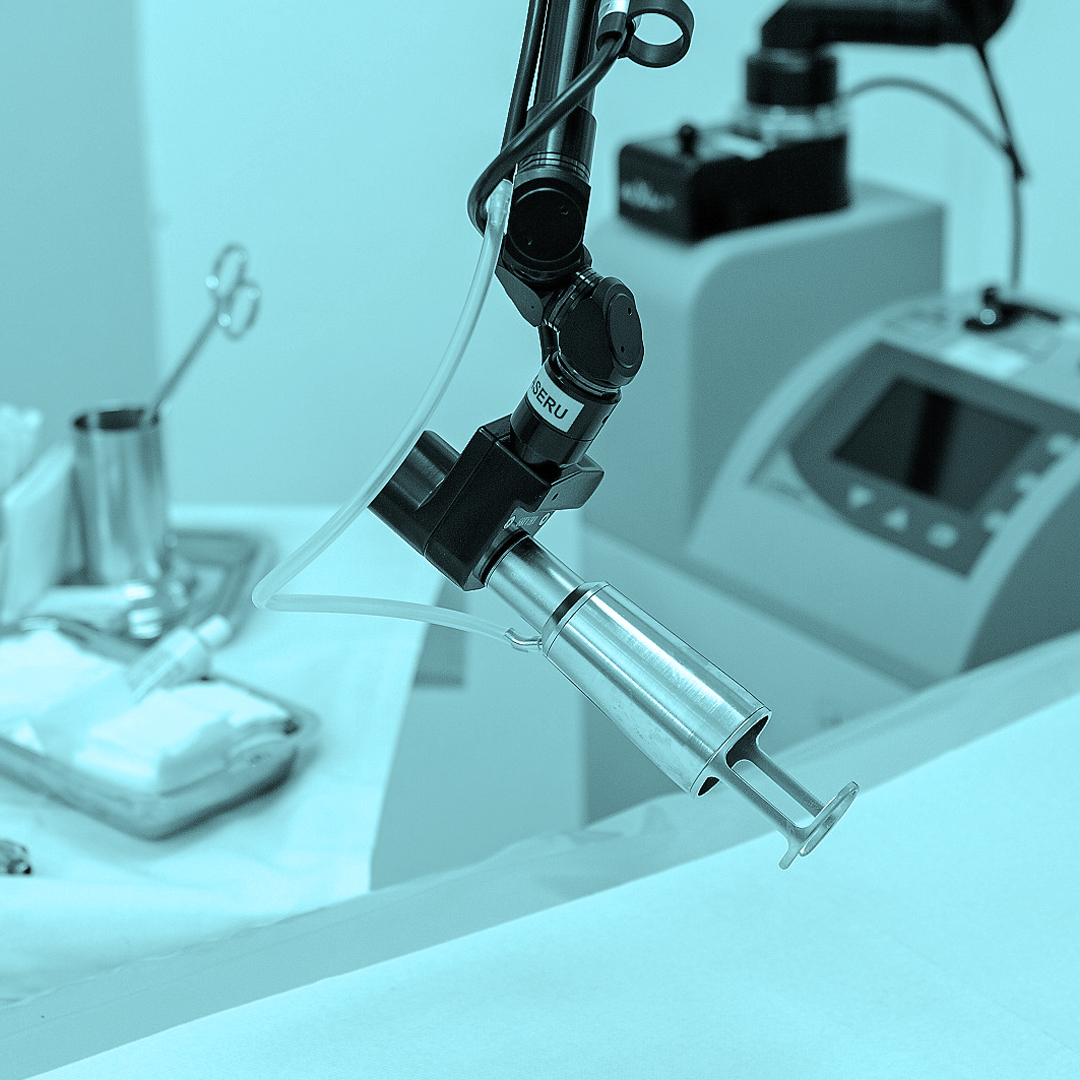 Nepravidelné pigmentové skvrny