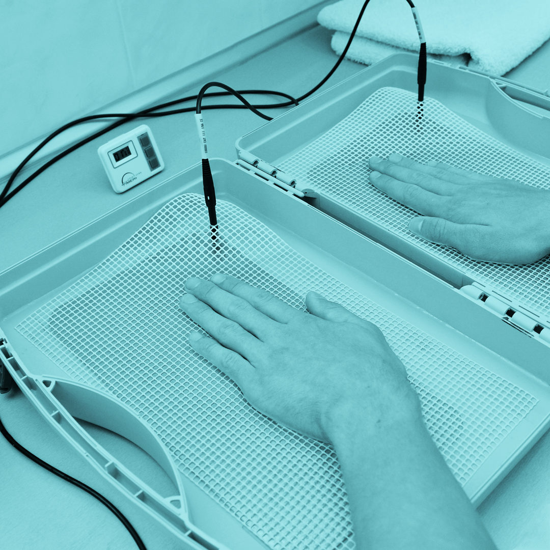 Odstranění nadměrného pocení